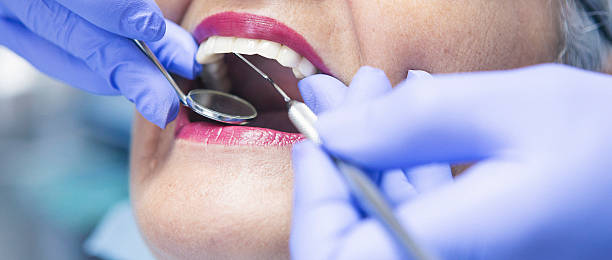 Best Emergency Tooth Extraction in Ponderay, ID